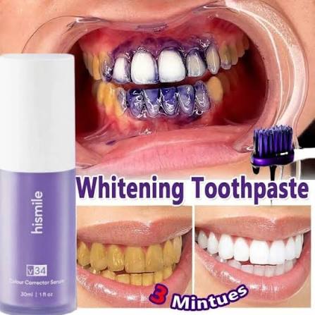 Hismile toothpaste for instant white teeth
