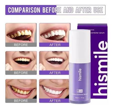 Hismile toothpaste for instant white teeth